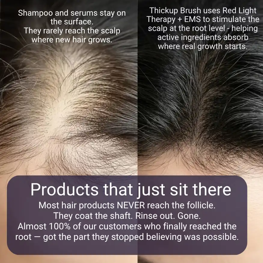 thumb image