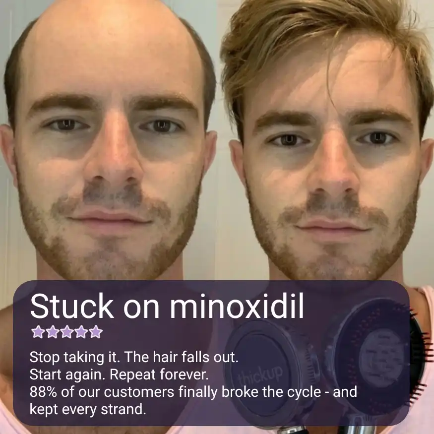 thumb image