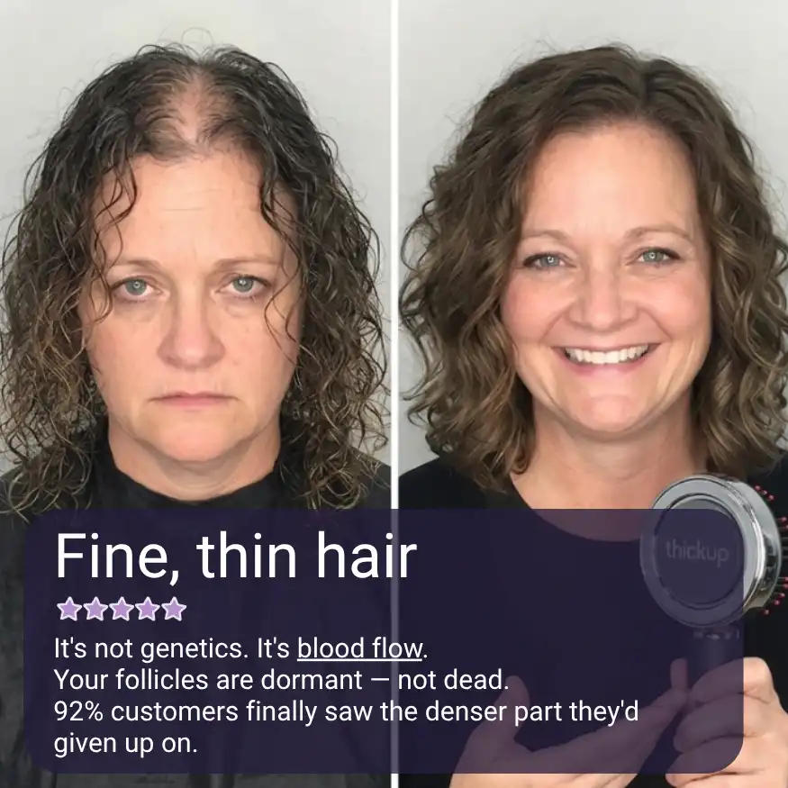 thumb image